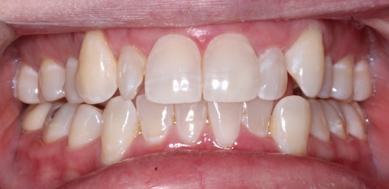 smile gallery image
