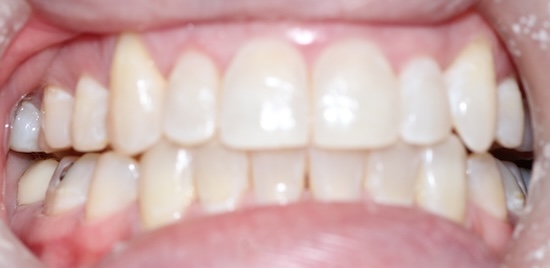 smile gallery image
