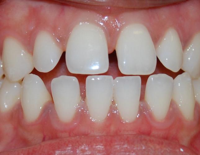 before image before image