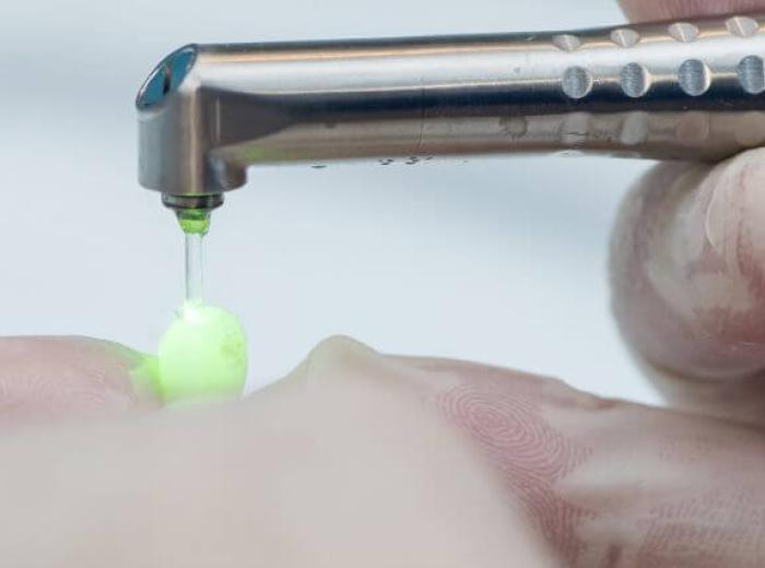 Are Dental Lasers Effective? What Patients Should Know