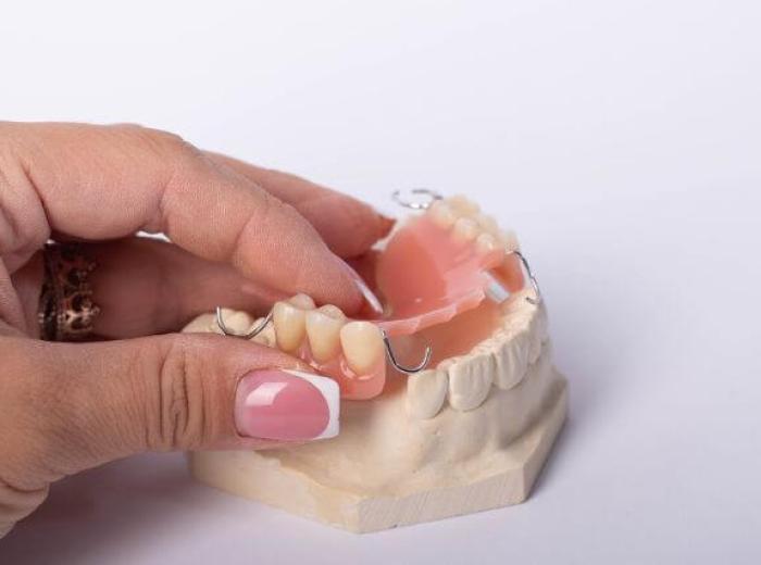 Cost Considerations: Understanding the Financial Aspects of Dental Bridges
