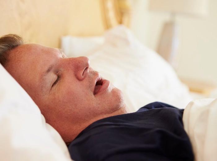 The Silent Connection: Sleep Apnea and Oral Health
