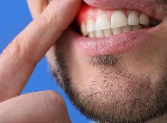 Holistic Approaches to Managing Periodontal Disease: Mind-Body Wellness